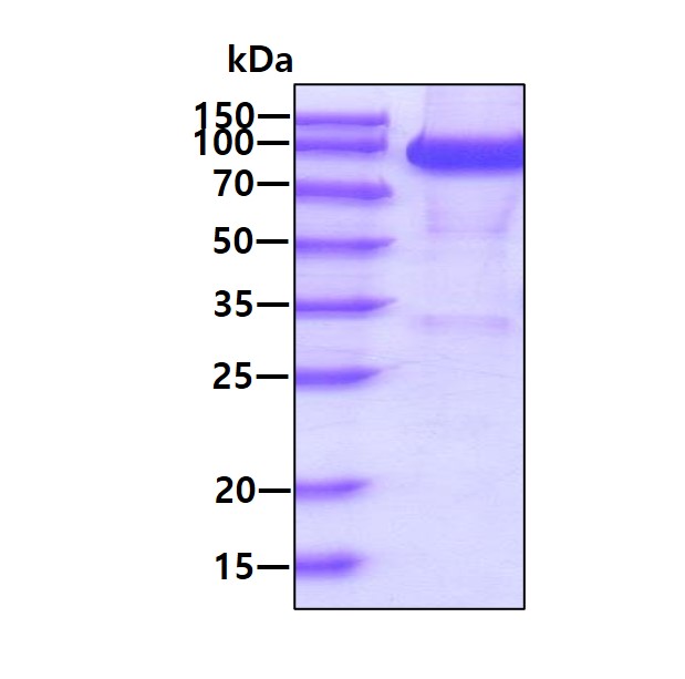 3 μg by SDS-PAGE under reducing condition and visualized by coomassie blue stain.